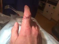 post-14887-14216898760034_thumb.jpg